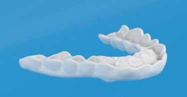 Ortoplus lança primeira placa de contenção de nylon fabricada em Espanha