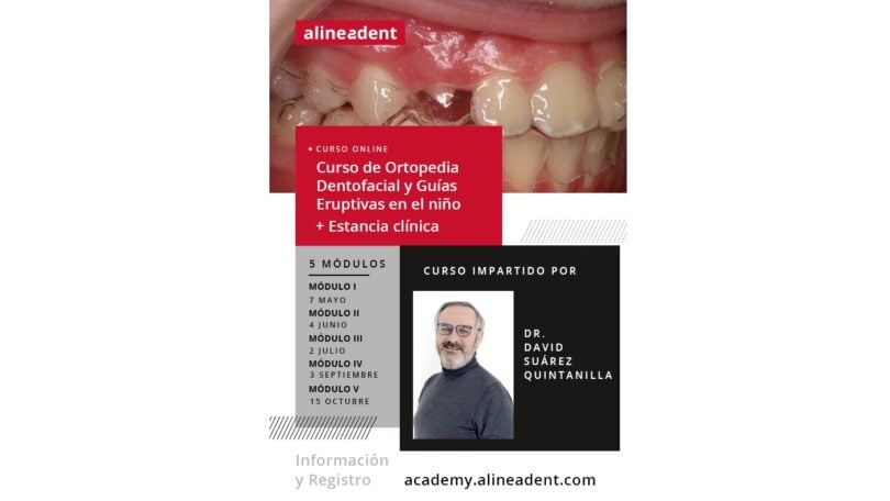Academia Alineadent organiza curso de ortopedia dento-facial