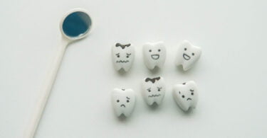 Estudo: Bactéria microbiana ligada ao desenvolvimento de cáries dentárias