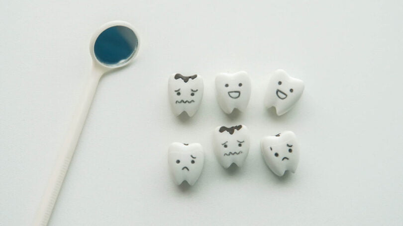 Estudo: Bactéria microbiana ligada ao desenvolvimento de cáries dentárias