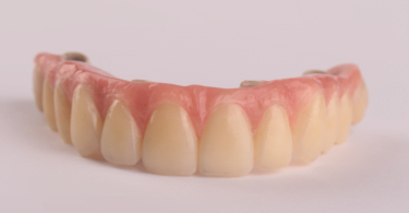 A aposta na técnica All-on-4 ® ganhou força com um estudo que pretende avaliar a viabilidade desta técnica com próteses Peek.