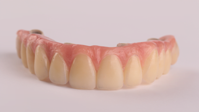 A aposta na técnica All-on-4 ® ganhou força com um estudo que pretende avaliar a viabilidade desta técnica com próteses Peek.