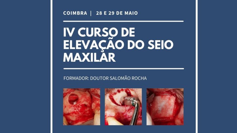 A Oriseducare irá realizar o IV Curso de Elevação do Seio Maxilar nos próximos dias 28 e 29 de maio, entre as 9h e as 19h. 