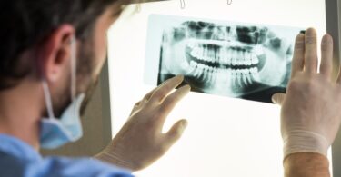 A OMD e a APA estão no final das negociações para um acordo sobre o processo de registo e licenciamento dos aparelhos de radiologia.