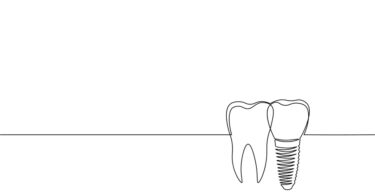 As novas previsões do iData Research antecipam o crescimento da indústria de enxertos ósseos nos Estados Unidos da América (EUA).