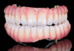 A Zirkonzahn, empresa de implantes e próteses dentárias, lançou as novas pastas cerâmicas Fresco Gingiva e Fresco Enamel.