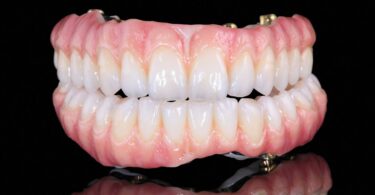 A Zirkonzahn, empresa de implantes e próteses dentárias, lançou as novas pastas cerâmicas Fresco Gingiva e Fresco Enamel.
