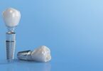 A Nobel Biocare lançou recentemente o GalvoSurge Dental Implant Cleaning System, que pretende ajudar na limpeza dos implantes.