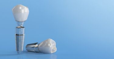 A Nobel Biocare lançou recentemente o GalvoSurge Dental Implant Cleaning System, que pretende ajudar na limpeza dos implantes.