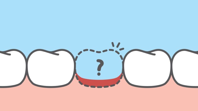 Um estudo revelou que a inteligência artificial (IA), através de dados médicos e socioeconómicos, pode ajudar a prever perda dentária.