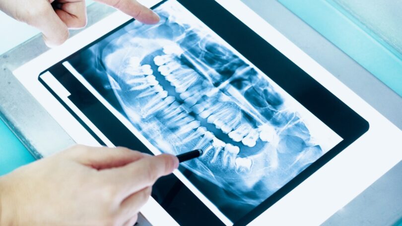 A AIEA lançou recentemente um novo curso de eLearning sobre Proteção contra Radiações em Radiologia Dentária, revela a FDI.