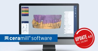 A Amann Girrbach anunciou a atualização Ceramill 4.0, que passa a integrar a atualização Exocad Galway, entre outras funções.
