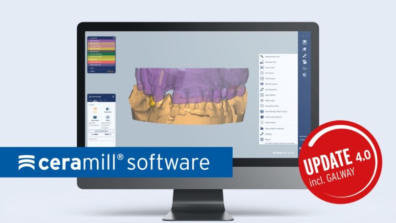 A Amann Girrbach anunciou a atualização Ceramill 4.0, que passa a integrar a atualização Exocad Galway, entre outras funções.