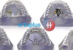 A Ortoplus lançou uma nova técnica Hybrid (TH) para diminuir o tempo dos tratamentos de ortodontia invisível.