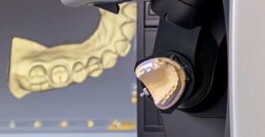 A Association of Dental Dealers in Europe (ADDE) anunciou a nova edição do seu relatório sobre a indústria dentária europeia.