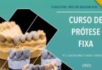 A Clínica CPRO – Prof. Dr. Genilson Neto já revelou o calendário para o seu curso de prótese fixa “Do Convencional às Novas Abordagens”.
