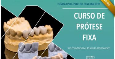 A Clínica CPRO – Prof. Dr. Genilson Neto já revelou o calendário para o seu curso de prótese fixa “Do Convencional às Novas Abordagens”.