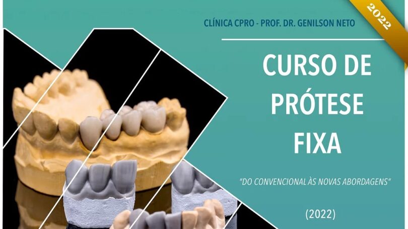 A Clínica CPRO – Prof. Dr. Genilson Neto já revelou o calendário para o seu curso de prótese fixa “Do Convencional às Novas Abordagens”.