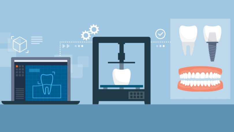 A indústria dentária de impressão 3D cresceu durante o terceiro trimestre de 2021, devido à necessidade de simplificar as consultas.