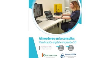 A nova edição do curso “Alinhadores na consulta: Planificação digital e impressão 3D” vai realizar-se a partir do dia 16 de junho.