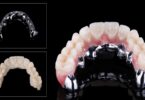 A Zirkonzahn anunciou uma barra, a Bartplatte, que permite realizar restaurações aparafusadas sobre implantes angulados.