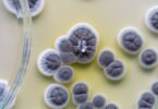 Estudo: Alergia a penicilina afeta sucesso de implantes dentários
