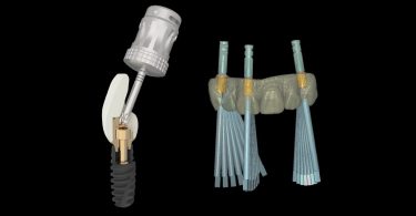 Zirkonzahn apresenta novas bases em titânio com canal de parafuso angulado