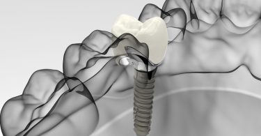 Nobel Biocare Symposium regressa inserido no Envista Summit