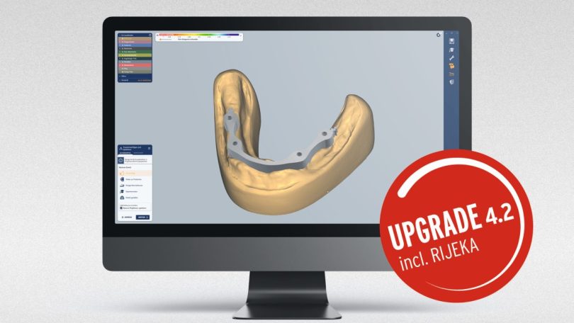 Software Ceramill Mind e Ceramill Match permite agora processar internamente titânio