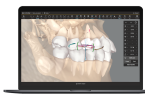 Align Tecnhology integra scanner CBCT no software Clincheck