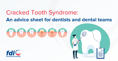 FDI lança advice sheet sobre síndrome do dente fissurado