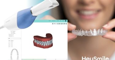 HeySmile é o novo sistema digital de alinhadores invisíveis