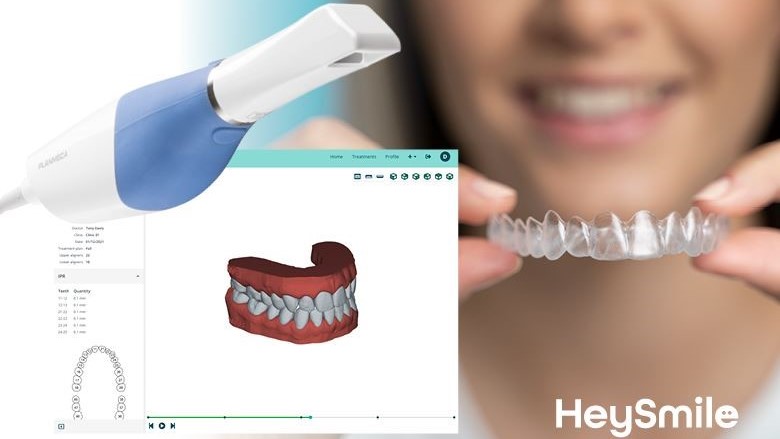 HeySmile é o novo sistema digital de alinhadores invisíveis