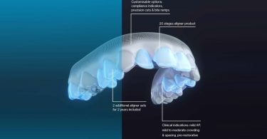 Invisalign Moderate Package vai ajudar na correção de maloclusões ligeiras a moderadas